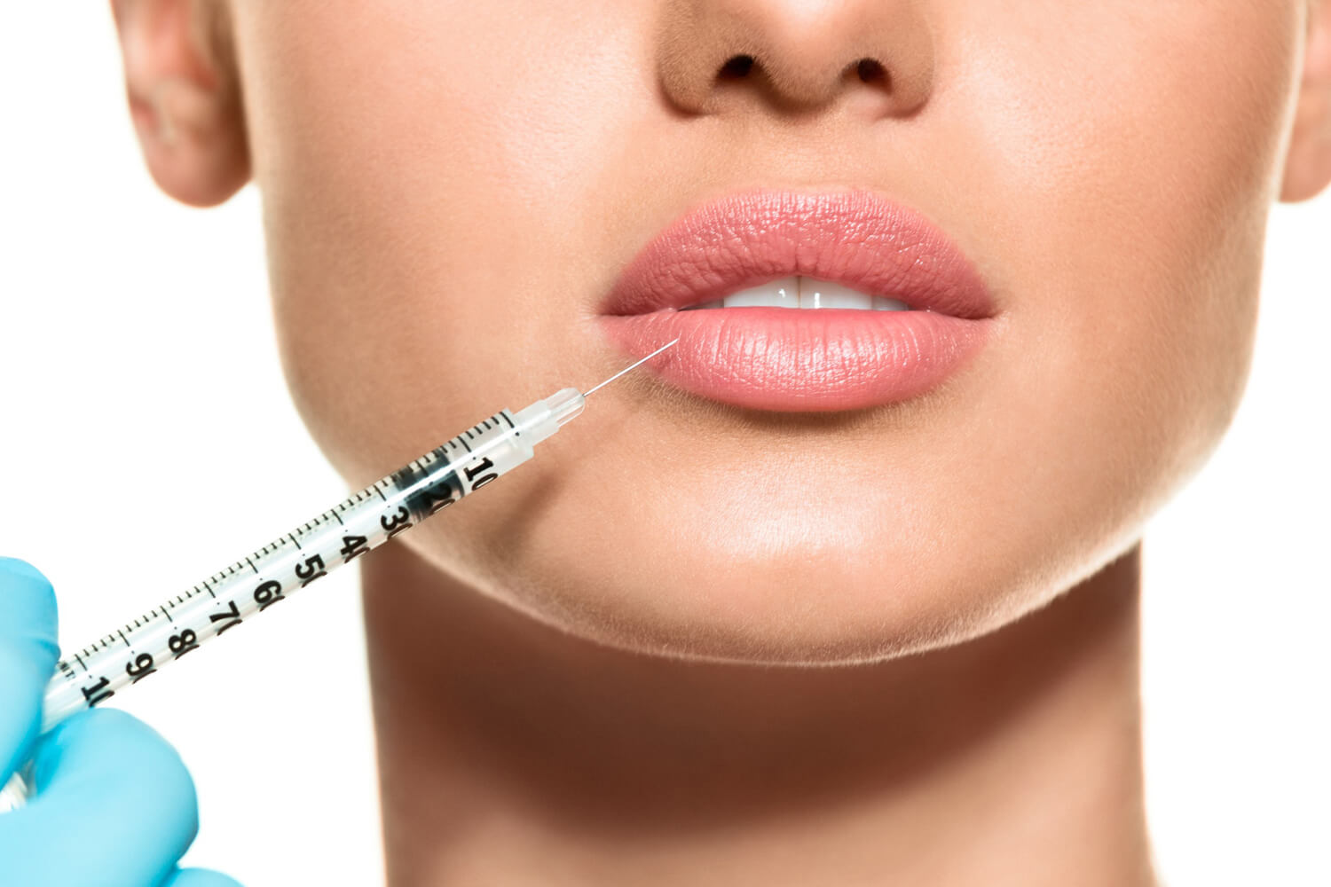 Dermal Fillers