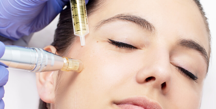 Mesotherapy Treatment